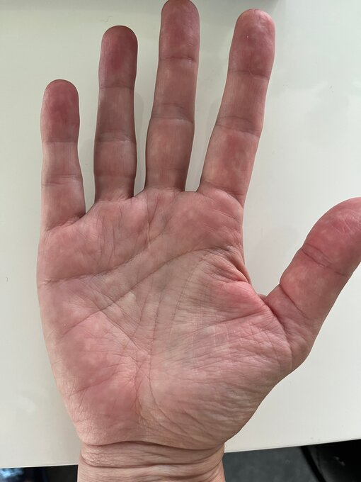 Правая рука. 