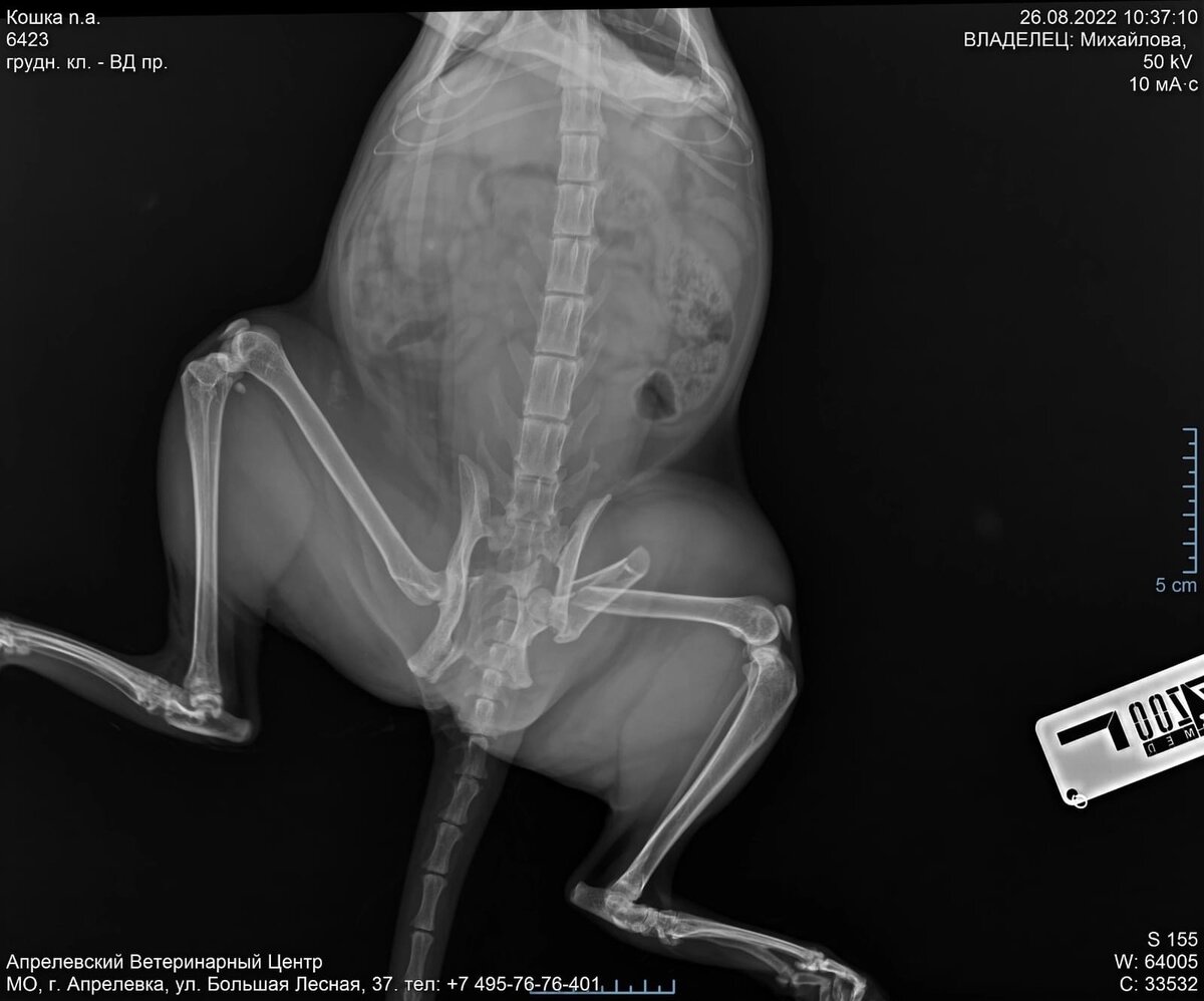 вот такой был первоначальный ренген
