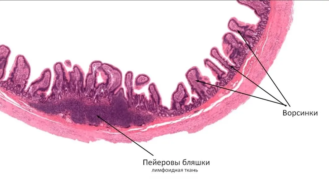 Подвздошная кишка гистология. Пейеровы бляшки гистология. Пейеровы бляшки тонкой кишки. Пейеровы бляшки гистология препарат. Подвздошная кишка пейеровы бляшки препарат гистология.