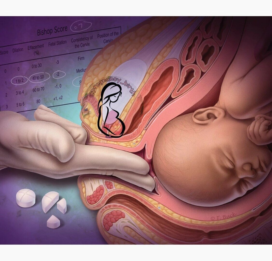оргазм во время родов из за чего фото 114