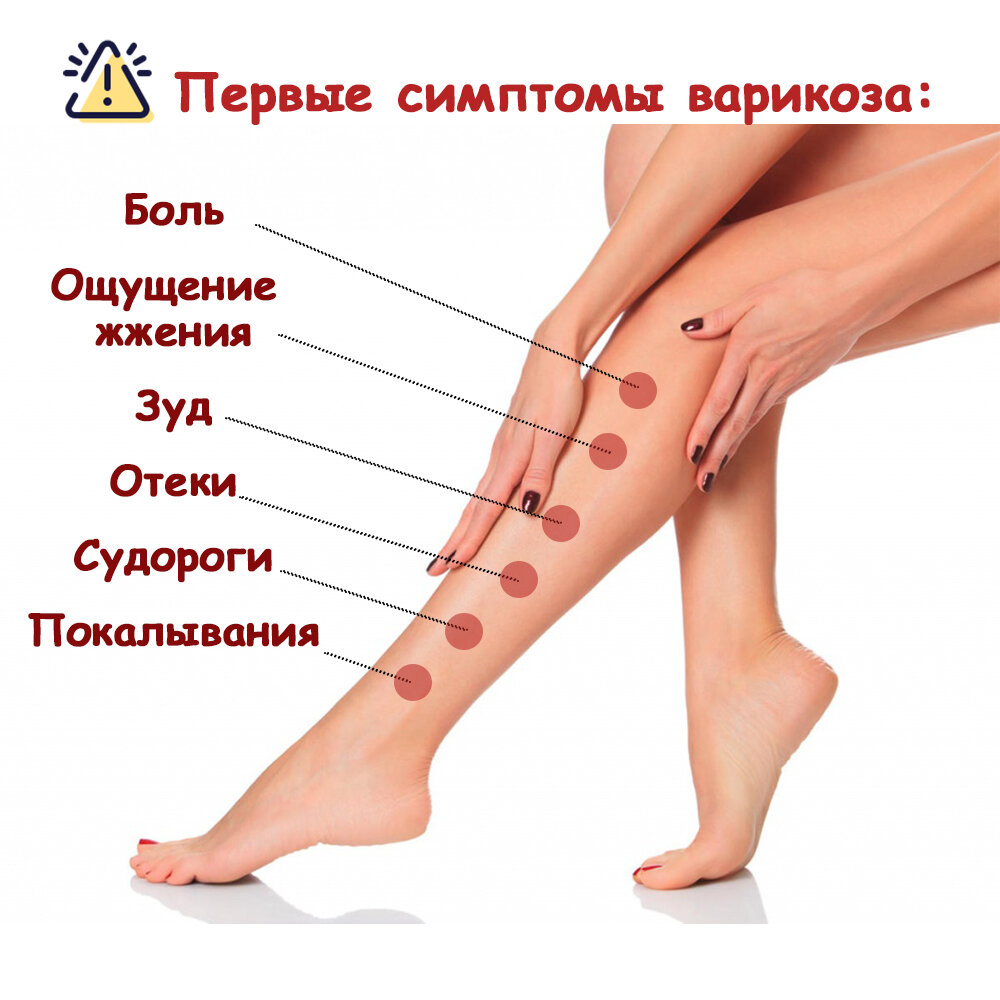 Варикоза нет про москва. Причины варикозного расширения вен на ногах. Симптомы варикоза на ногах симптомы. Первые проявления варикоза.