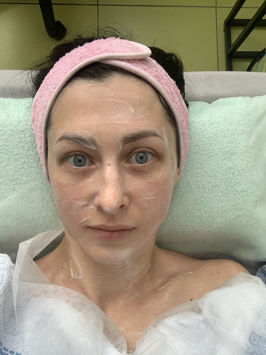 Это я сегодня после массажа и карбокситерапии