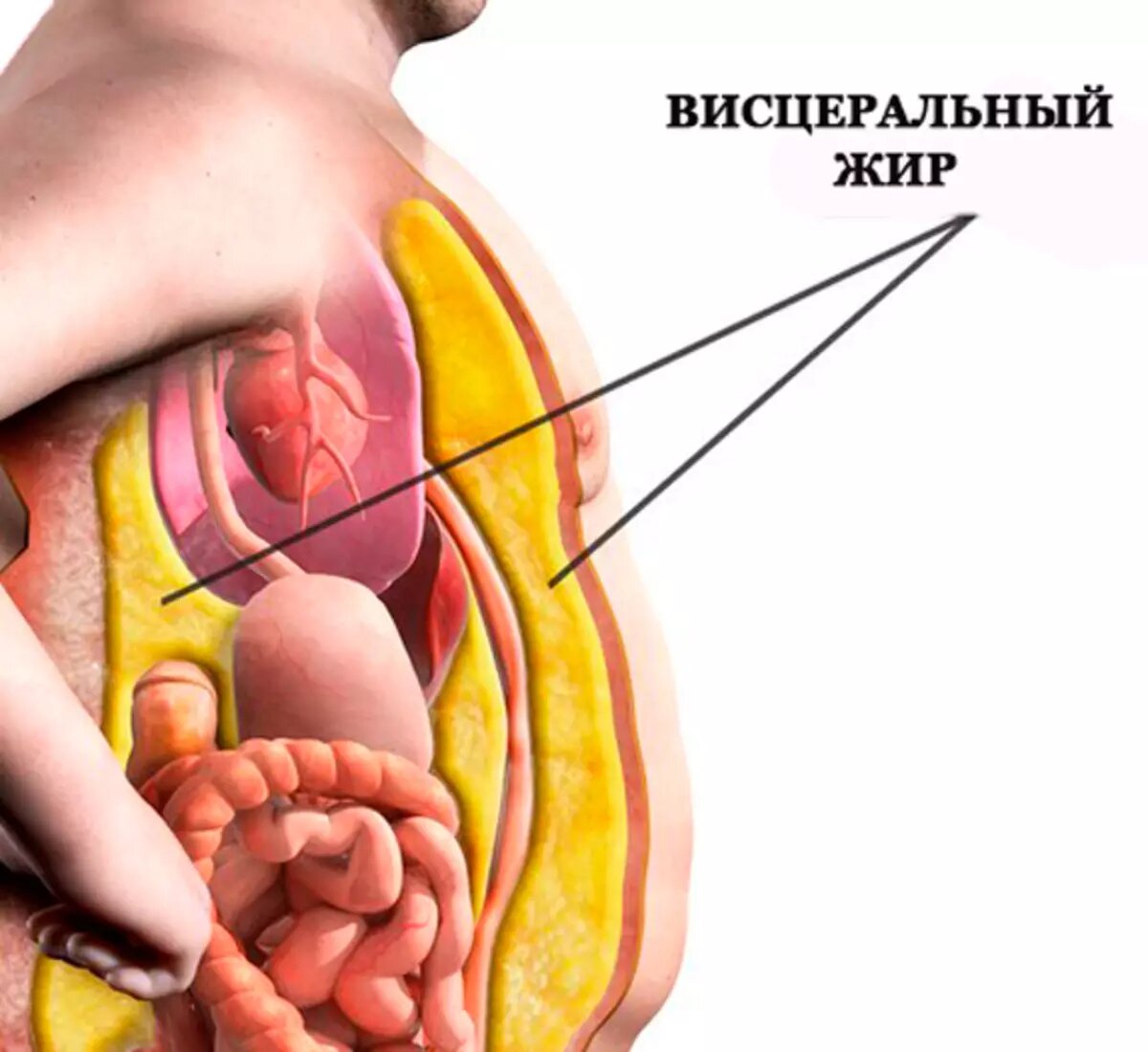 Висцеральный жир картинка