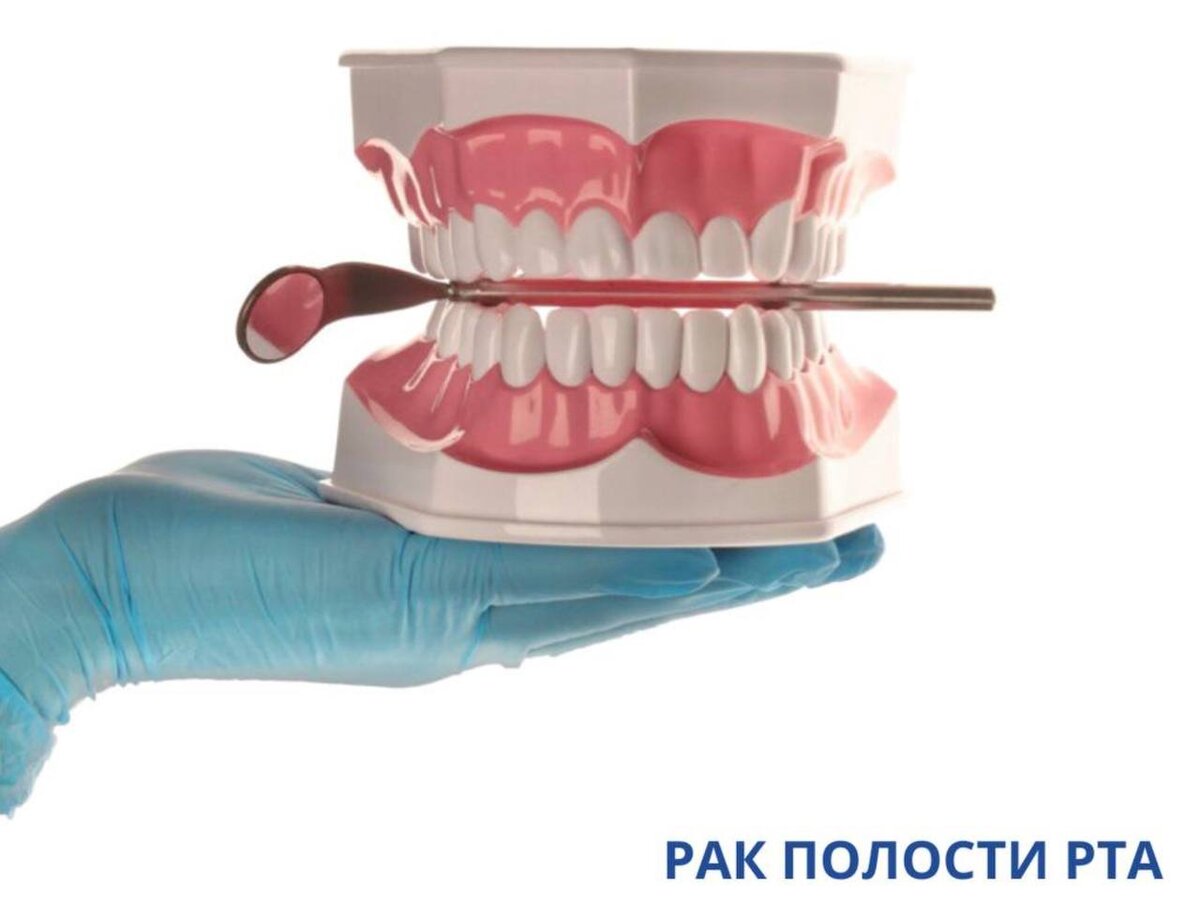 Ранняя диагностика раковых образований в полости рта может спасти жизнь.  Кейс от Articon | ARTICON цифровая стоматология в Москве | Дзен