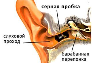 Шум в ушах и голове. Причины и лечение шума в ушах