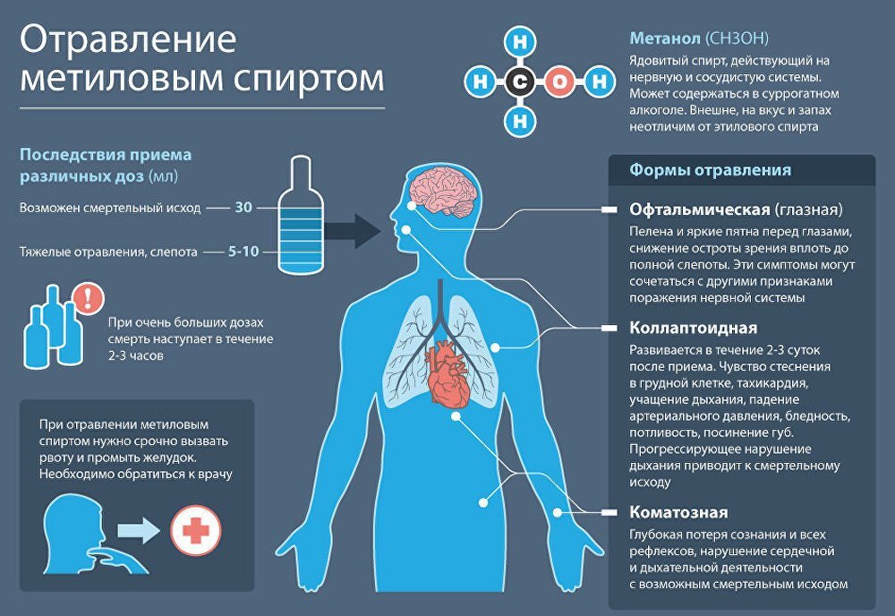 Алкогольная интоксикация: первая помощь при отравлении алкоголем