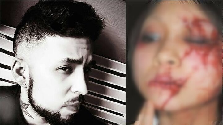 Видео есть на ютубе. Мы не можем нарушать нормы морали, т.к видео действительно жестокое.