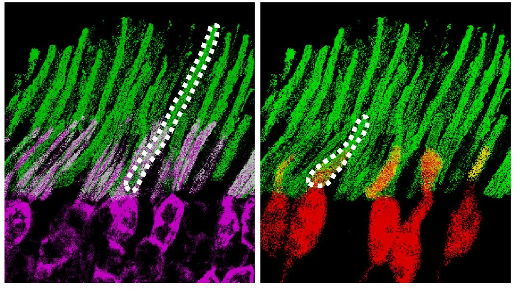 Зелёные наночастицы, осевшие на палочках (слева) и колбочках (справа). (Фото: Y. Ma et al., Cell, 2019)