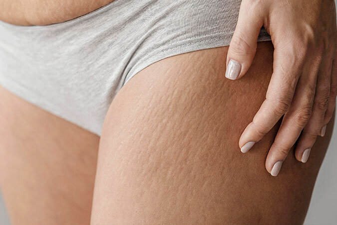 Благодарим за фото freepix