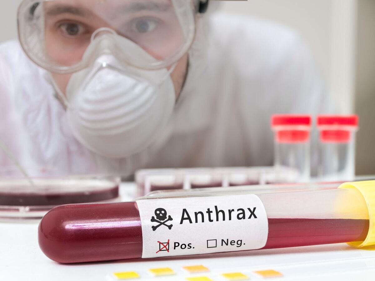    Научный сотрудник изучает образец крови на сибирскую язву© iStock.com / vchal