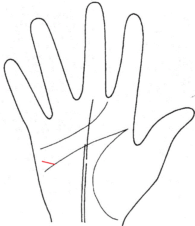 Знак "Черпачек денег" на линии головы