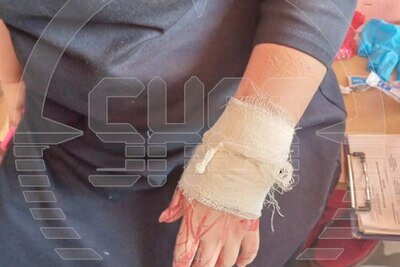    13-летняя девочка порезала одноклассниц в Башкирии. ©Telegram-канал SHOT