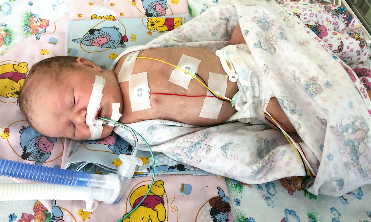 Полина Кукина, подопечная фонда "Алёша"