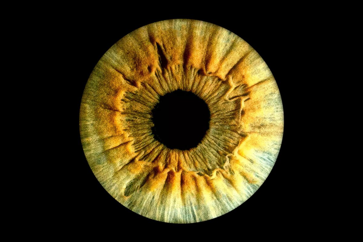 сурен манвелян глаза человека. фото радужки пермь. фото радужки пермь. фото радужки пермь. большие и маленькие зрачки.