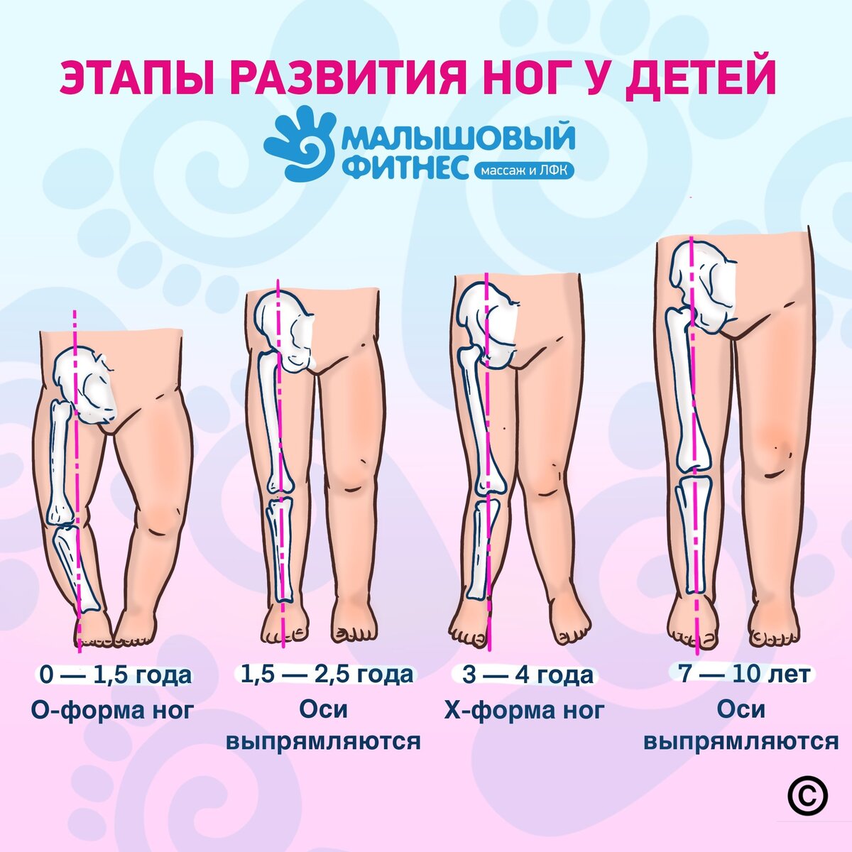 Этапы развития ног у детей