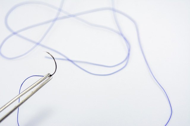    Что за «умные» нити для швов, распознающие и подавляющие воспаления?