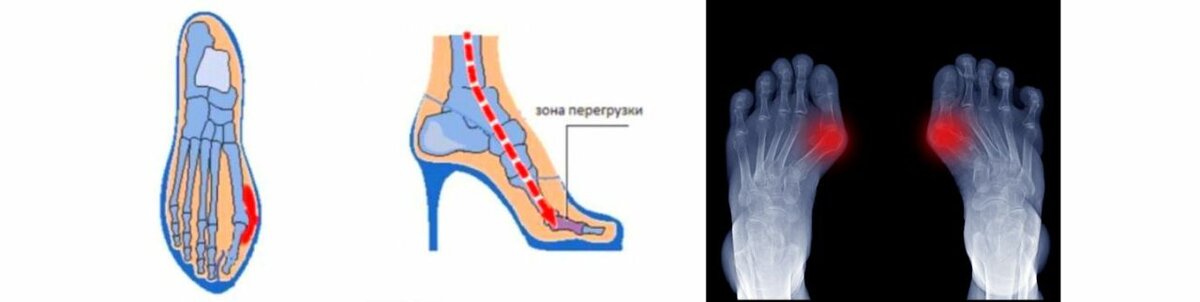 Выступление учителя – дефектолога Желтовой Елены Геннадьевнына родительском клубе «Мы вместе»