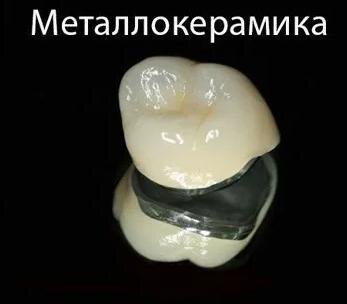 Металлокерамика или циркониевые коронки: что выбрать | Стоматология ...