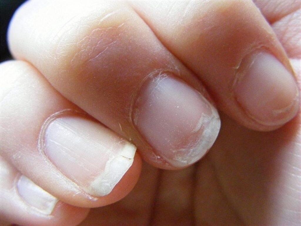 Почему здоровые ногти важны