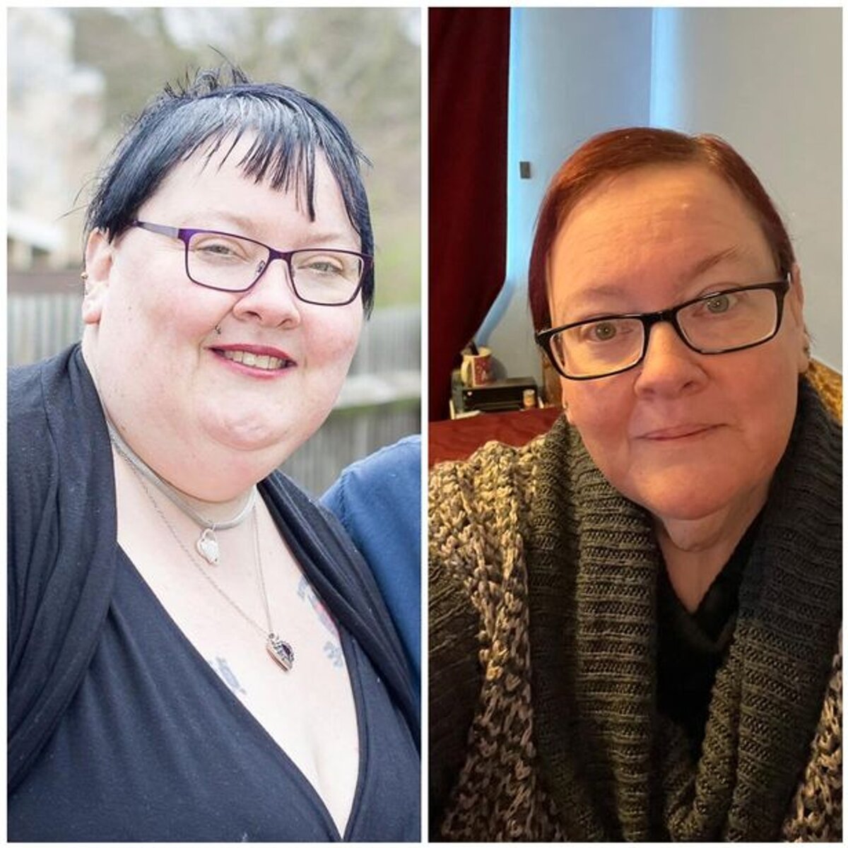    Саманта Кобб до и после похудения Фото: EssexLive