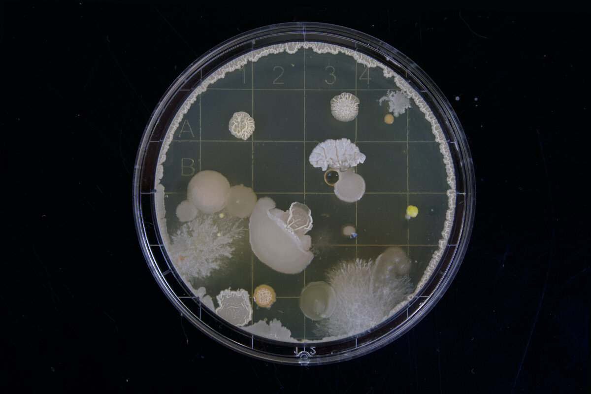 Факты об инфицировании кишечной палочкой E. coli, продуцирующей шига-токсин (STEC)