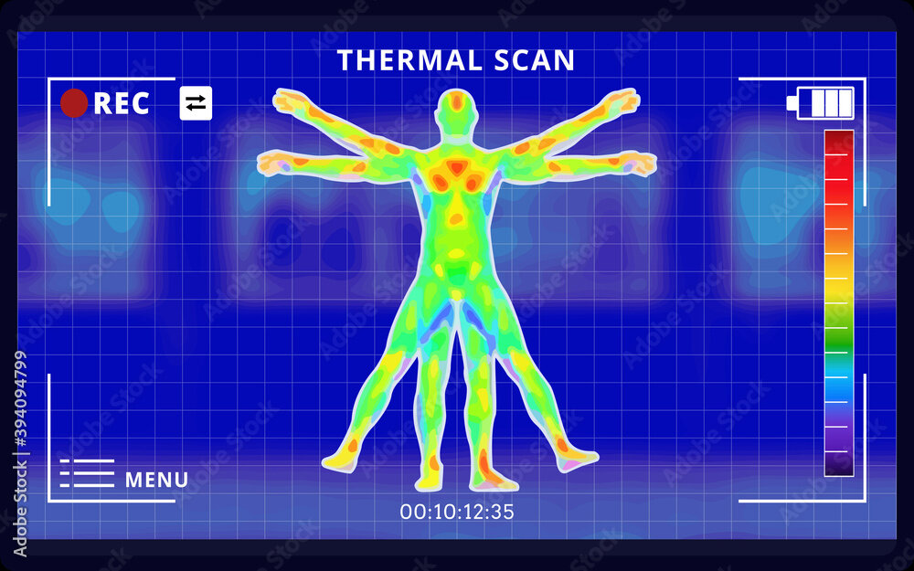 Термография | Диагностика рака груди в Израиле | Imedical