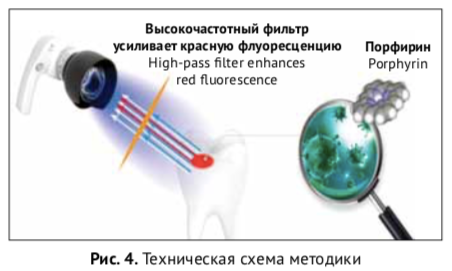 Иллюстрации к исследованию из электронной версии журнала "Пародонтология"
