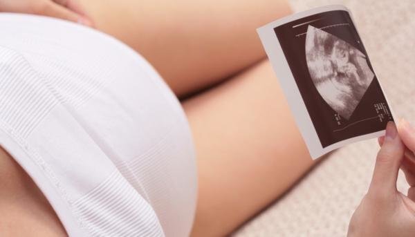 17 неделя беременности