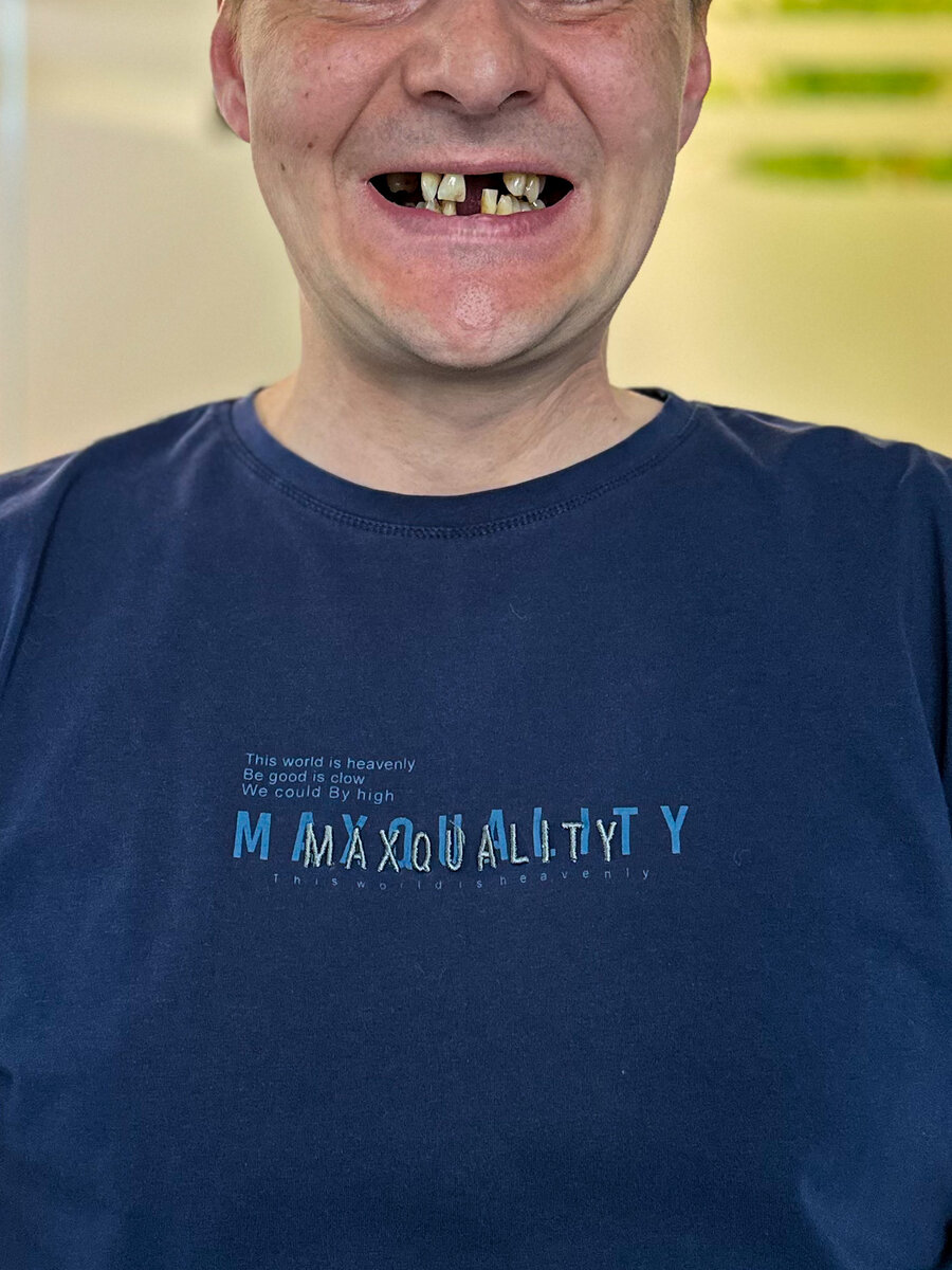 Ситуация до.