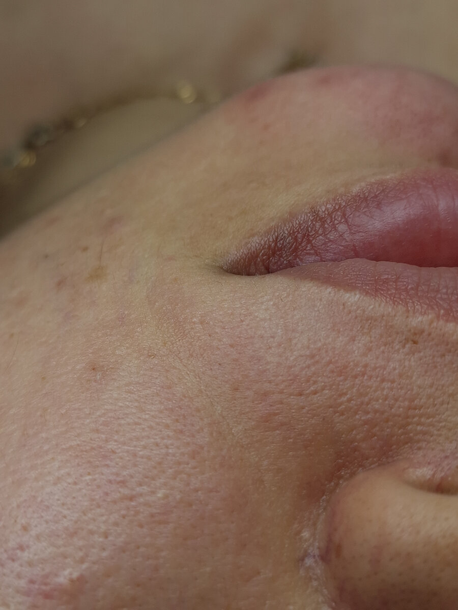 После прохождения курса процедур ЭЭ