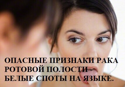 ОПАСНЫЕ ПРИЗНАКИ РАКА РОТОВОЙ ПОЛОСТИ - БЕЛЫЕ СПОТЫ НА ЯЗЫКЕ.