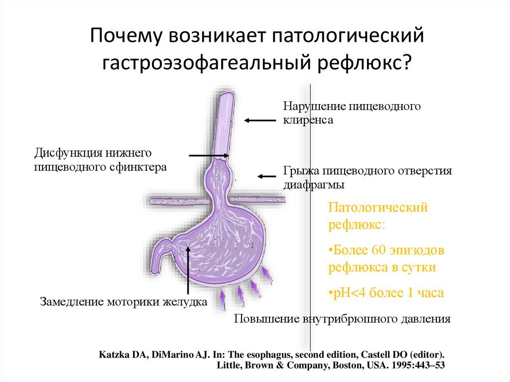 Препараты при эзофагите. Билиарный рефлюкс гастрит и рефлюкс эзофагит. Схемы терапии билиарного рефлюкса. Дуоденальное билиарный рефлюкс. При забросе желчи в желудок.