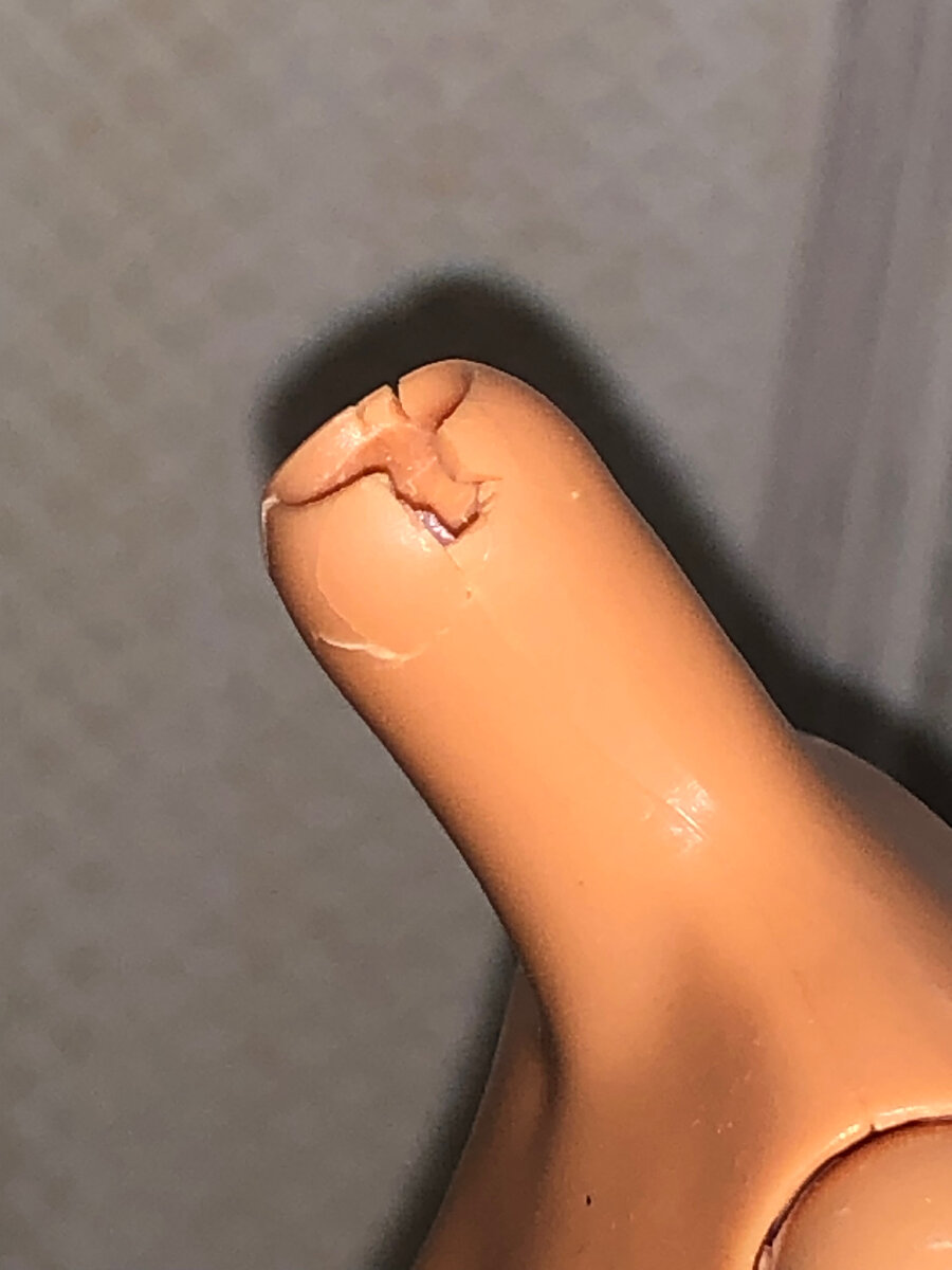 Отсутствует кусок шеи с одной стороны. 