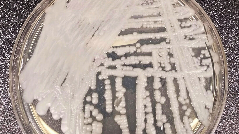    Candida auris © Wikipedia.org