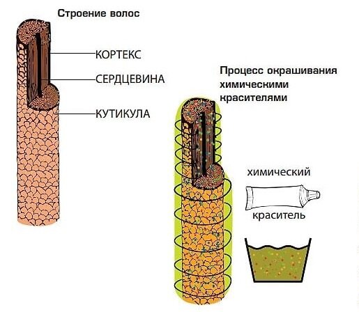 Волдыри на голове от краски