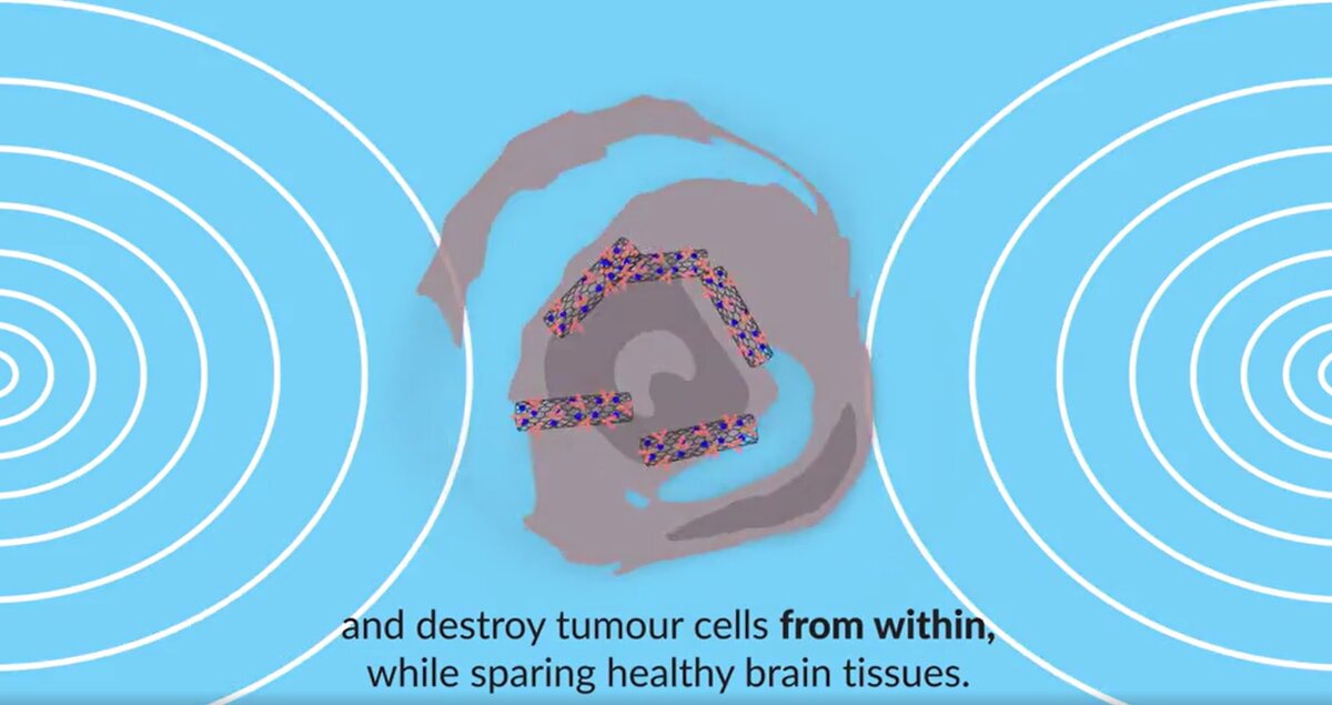    Нанотрубки в раковой клетке под действием магнитного поляhttps://www.science.org/doi/10.1126/sciadv.ade5321