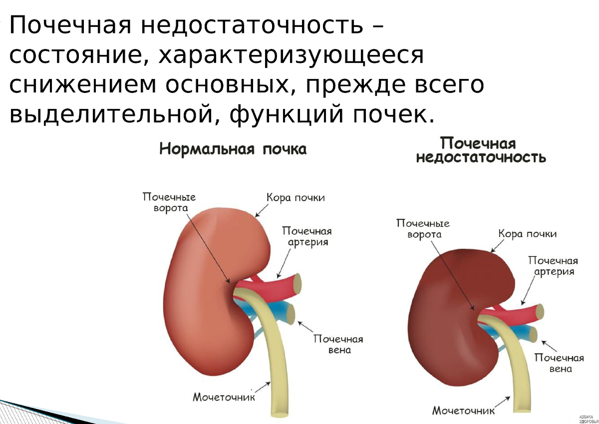 Снижение почечной функции. Снижена функция почек причины. Недостаточность функции почек. Ослабление функции почек. Увеличена левая почка