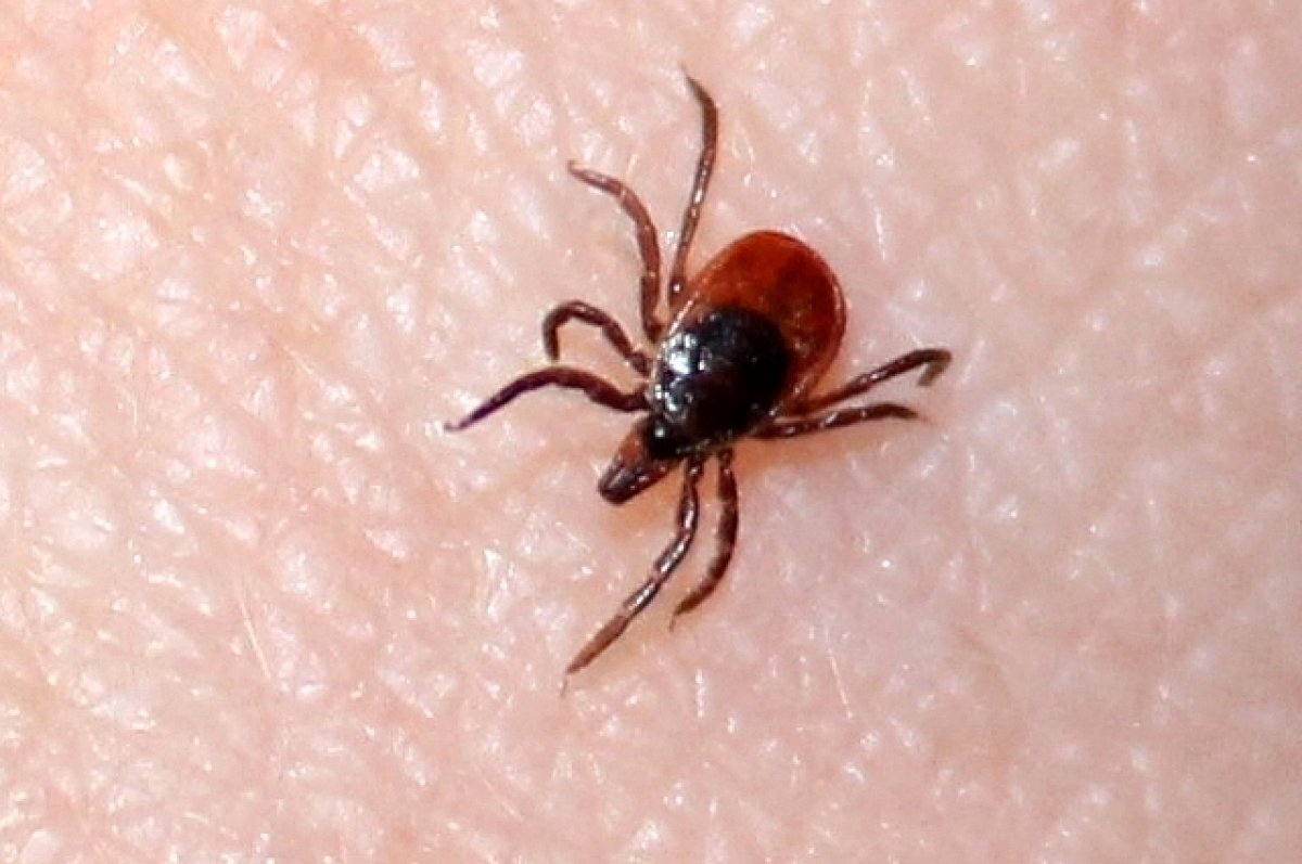    В Новосибирской области у двух человек заподозрили клещевой энцефалит
