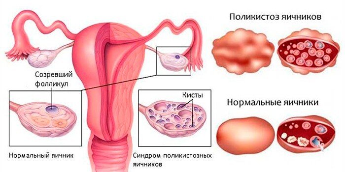 вот так это выглядит