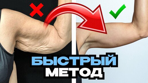 Как подтянуть обвисшие руки без диет и фитнеса. Липосакция рук и плеч