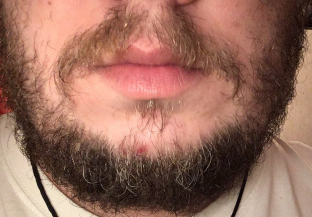 Фотография взята из источника obritye.ru