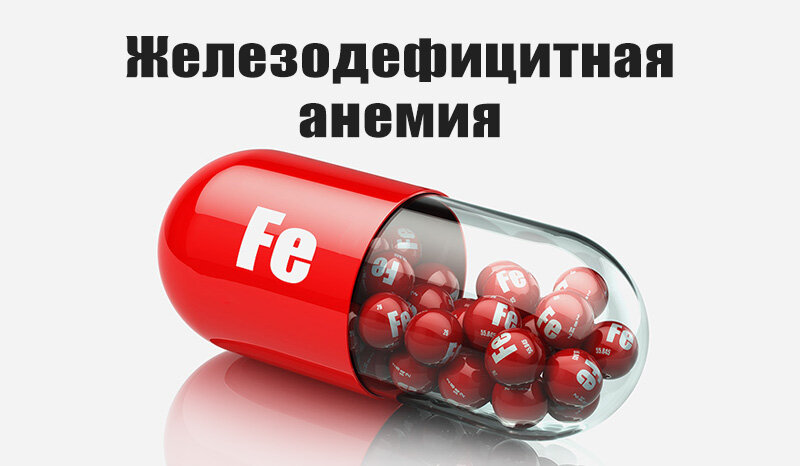 Железодефицитная анемия картинки