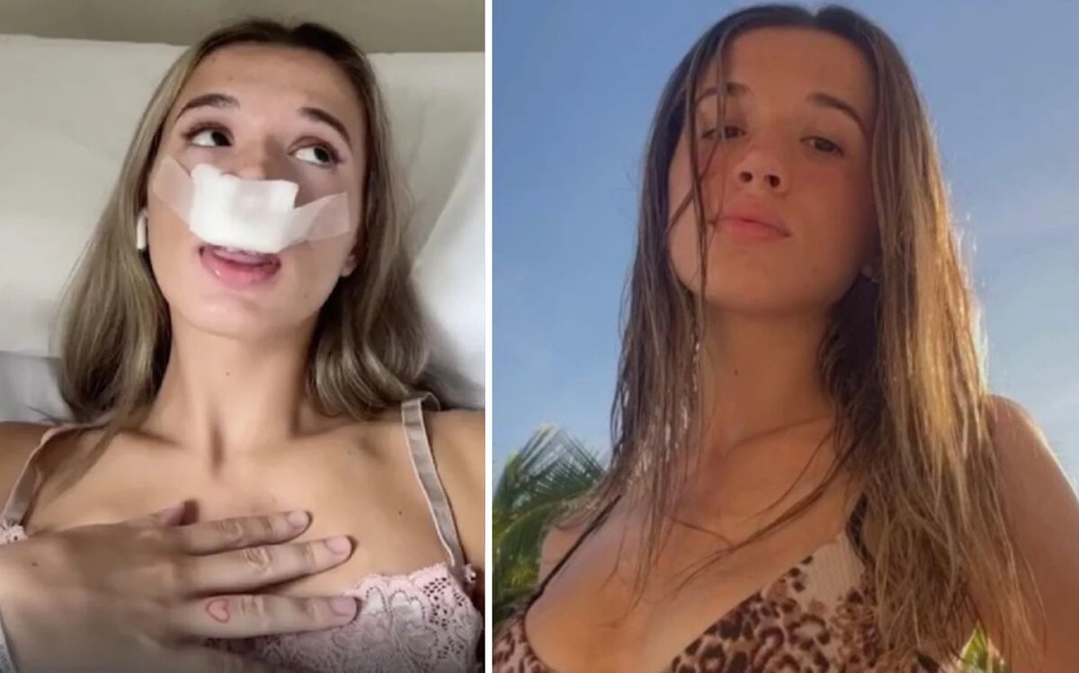 Фиоре Чиминелло "до и после"