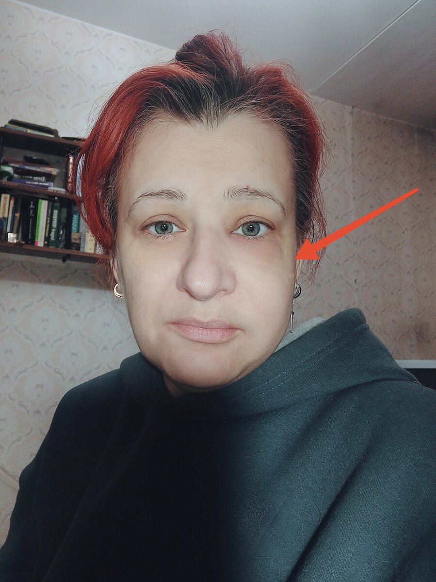 -2