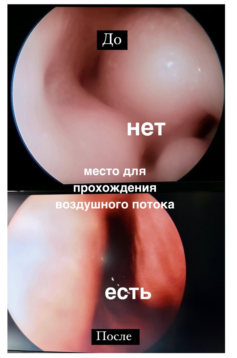 -1-3