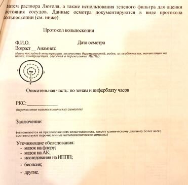 Шейка матки: визуализируется, не визуализируется
Форма: коническая, цилиндрическая
Размер: нормальный, гипертрофирована
Наружный зев: точечный, щелевидный
Цвет: гладкая, блестящая, розовая, бледно-розовая, гиперемированная
Рубцовая деформация:(разрыв, надрыв, зияние, эктропион)
отсутствует, незначительная, умеренная
Экзофитные и другие образования: не выявлены
Характер выделений: светлые, слизистые (скудные, обильные)

ПОСЛЕ ОБРАБОТКИ 3% РАСТВОРОМ 
УКСУСНОЙ КИСЛОТЫ ОБНАРУЖЕНО:
Кольпоскопическая картина: 
·	Удовлетворительная 
(стык между МПЭ и ЦЭ визуализируется полностью), 
·	Неудовлетворительная 
(стык не визуализируется или стык плоского и цилиндрического эпителия не визуализируется полностью)
–	может из-за воспаления, кровотечения, деформации

Влагалищная часть шейки матки покрыта:
·	цилиндрическим эпителием, расположенный участками, вокруг наружного зева занимает зоны: 11
·	цилиндрическим эпителием, расположенный участками, вокруг наружного зева занимает зоны: 11 + участками метапластического эпителия
·	цилиндрическим эпителием, расположенный небольшим участком по задней губе, вокруг наружного зева, занимает зоны: 11
·	метапластическим эпителием
·	оригинальным МПЭ

ЗОНА ТРАНСФОРМАЦИИ: 
·	1 тип ЗТ,
·	2 тип ЗТ, 
·	3 тип ЗТ


Островки цилиндрического эпителия: единичные, множественные, не определяются
Открытые протоки желез: единичные, множественные, не определяются, определяются
Ободок желез: обычный, утолщен
Кистозно - расширенные железы: единичные, не определяются, множественные
Ацето - белый эпителий: не определяется,определяется в ЗТ/вне ЗТ тонкий появляется постепенно
Мозаика: не определяется, определяется, нежная, определяется сразу
Пунктация: не определяется
Сосуды: без особенностей

ПОСЛЕ ОБРАБОТКИ РАСТВОРОМ ЛЮГОЛЯ:
Окрашивание: равномерное
Йод - негативная зона: определяется, не определяется, определяется на 6 часах
Разные результаты: воспаление

Кольпоскопическое заключение:
Нормальная кольпоскопическая картина (оригинальный сквамозный эпителий)
Неудовлетворительная кольпоскопия (стык эпителиев невозможно визуализировать)
Ненормальная КСК (АБЭ, йод - негативный эпителий, атипические сосуды), L-SIL, гипертрофия шейки матки
Ненормальная КСК (АБЭ. Мозаика. Пунктация).
Йод - негативный эпителий, атипические сосуды: L-SIL
Эктопия цилиндрического эпителия. Зона трансформации...2 тип
Косвенные признаки ВПЧ
Косвенные признаки ВПЧ + воспаление
Рубцовая деформация шейки матки
Зона трансформации...3 тип.

Диагноз клинический/предварительный
Частично - перекрытая эктопия ш/матки.
Частично - перекрытая эктопия ш/матки. Носитель ВПЧ?
Частично - перекрытая эктопия ш/матки с подозрением на Д1.
Частично - перекрытая эктопия ш/матки с подозрением на Д1 + гипертрофия ш/матки.
Носитель ВПЧ? + Подострый кольпит

Рекомендовано:
наблюдение
к/с 1 раз в год
обследование на ВПЧ + к/с через 3 мес (с результатами обследования)
обследование на ВПЧ + к/с 1 раз в год + цитология 1 раз в год
обследование на ВПЧ + ИППП + противовоспалительная терапия+ к/с 1 раз в год + цитология 1 раз в год
обследование на ВПЧ + биопсия ш/матки
ДТК

