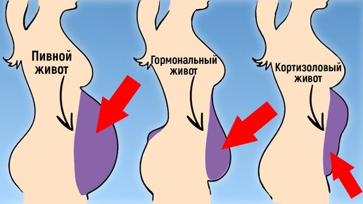 Это заставляет нас ТОЛСТЕТЬ и ТЕРЯТЬ ПАМЯТЬ! / Что за гормон КОРТИЗОЛ?