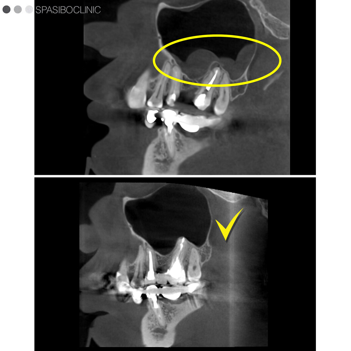 КИСТЫ: УДАЛЯТЬ? ЛЕЧИТЬ! | Спасибо.Клиник | Дзен