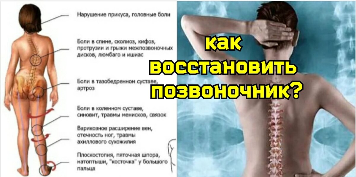 Как лечить спину если защемило нерв