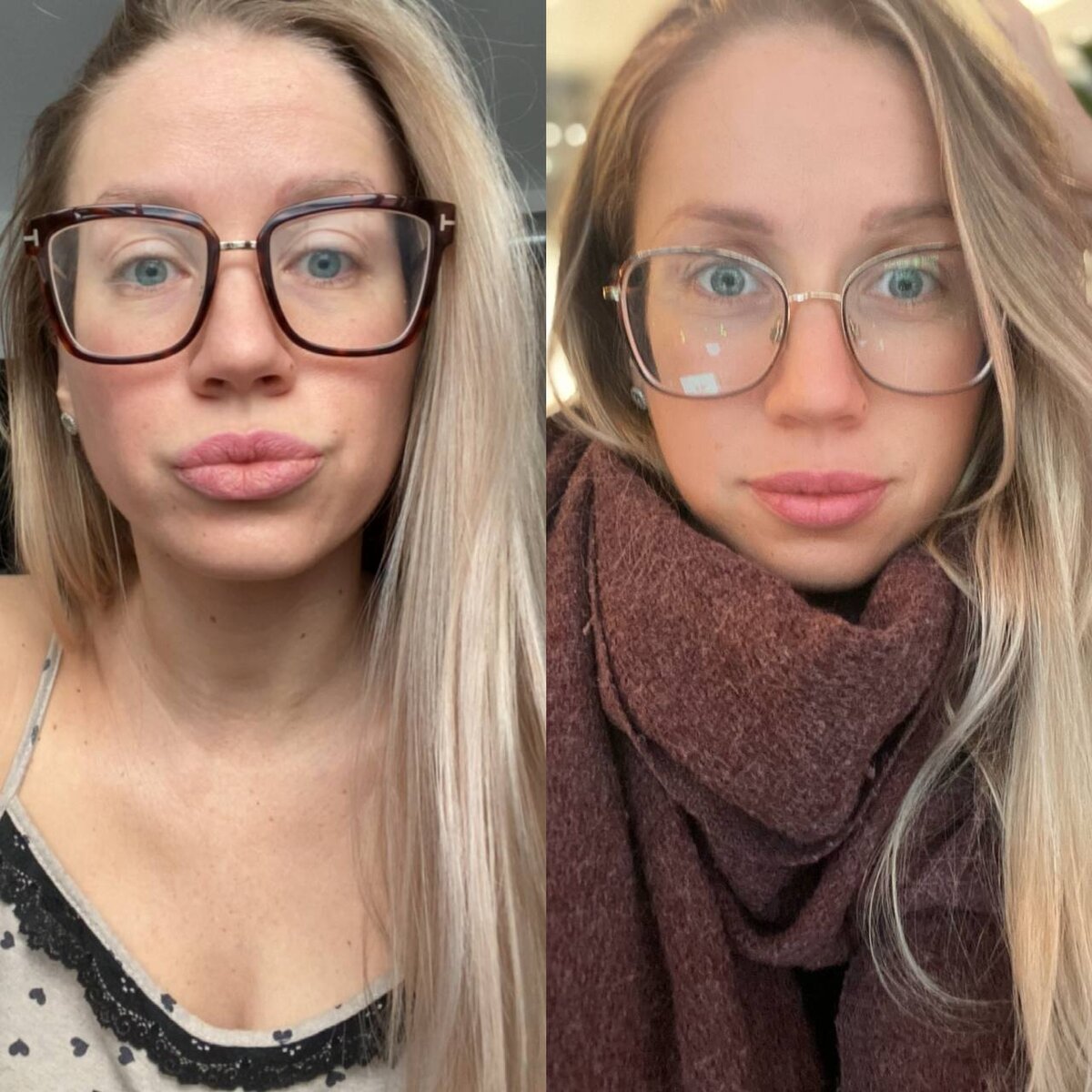 -2